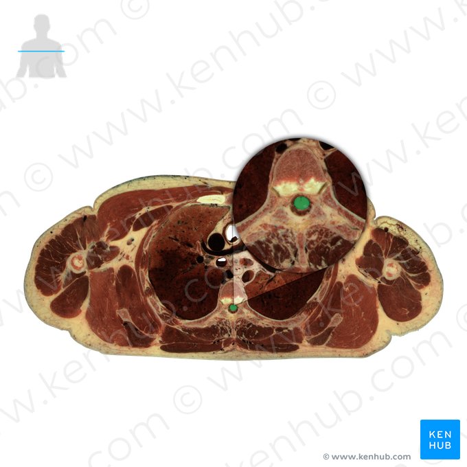 Spinal cord (Medulla spinalis); Image: National Library of Medicine