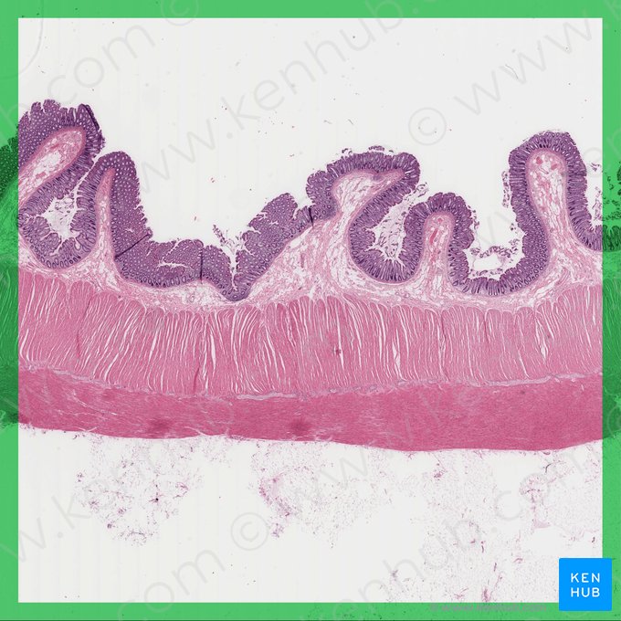 Colon; Image: 