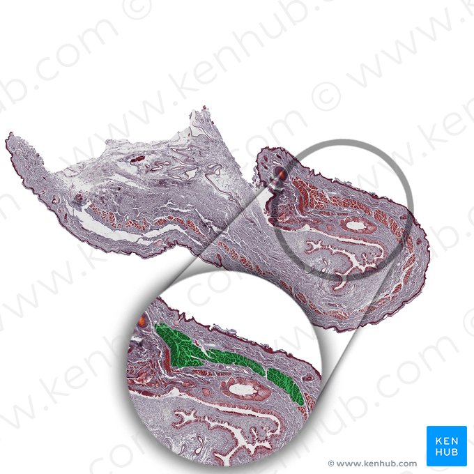 Músculo orbicular del ojo (Musculus orbicularis oculi); Imagen: 