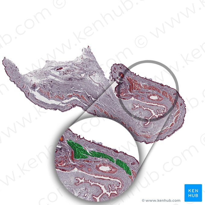 Orbicularis oculi muscle (Musculus orbicularis oculi); Image: 