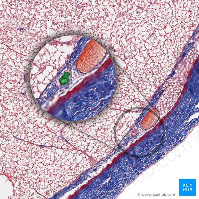 Anterior radicular artery (Arteria radicularis anterior); Image: 