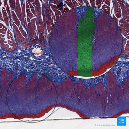 Epitelio escamoso estratificado no queratinizado (Epithelium stratificatum squamosum non cornificatum); Imagen: 