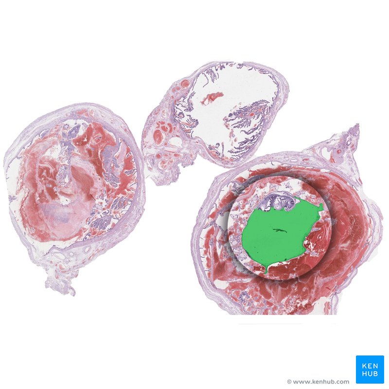 Amniotic sac - histological slide