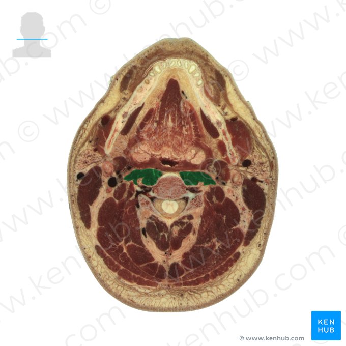 Longus capitis muscle (Musculus longus capitis); Image: National Library of Medicine