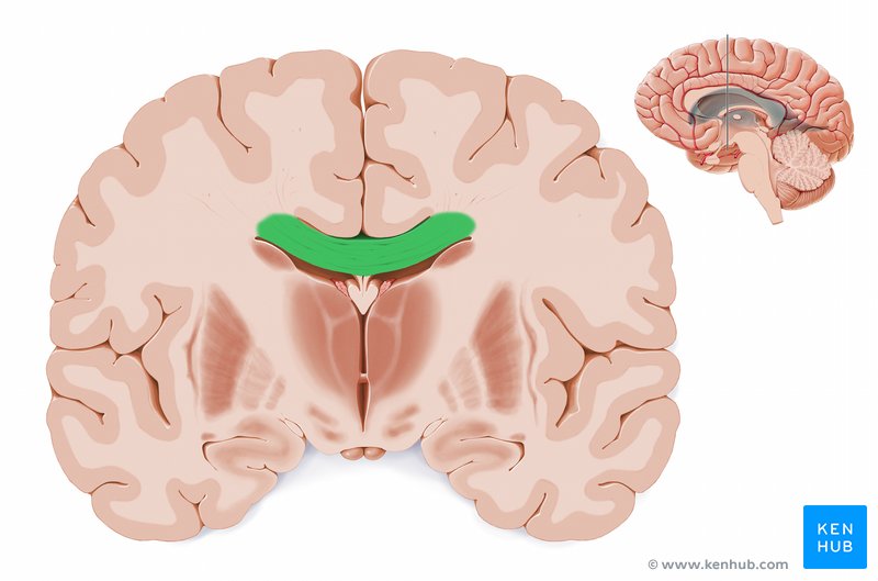 Coronal sections of the brain: Anatomy | Kenhub