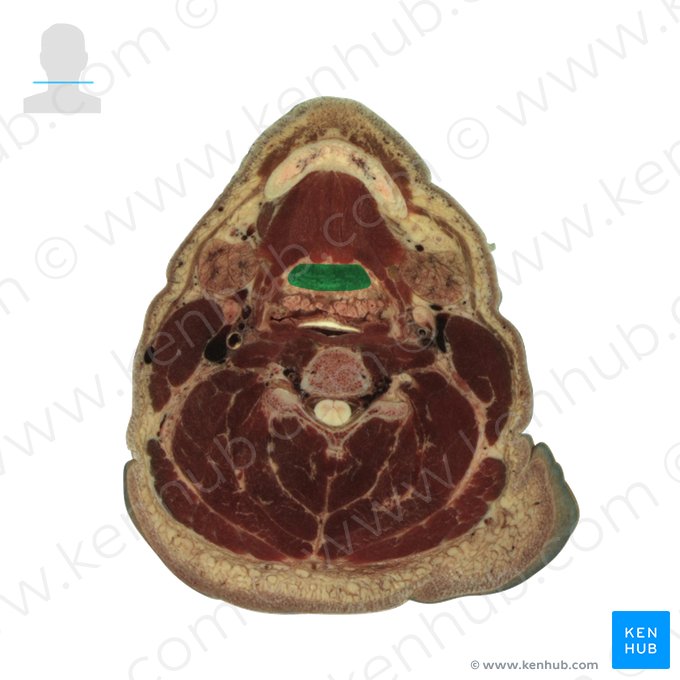 Root of tongue (Radix linguae); Image: National Library of Medicine