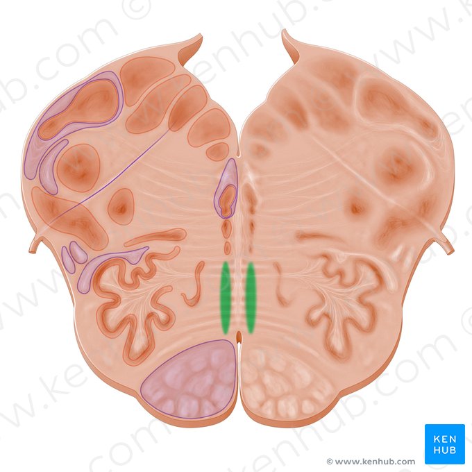 Lemnisco medial (Lemniscus medialis); Imagem: Paul Kim