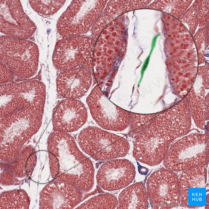 Fibroblasto (Fibroblastus); Imagen: 