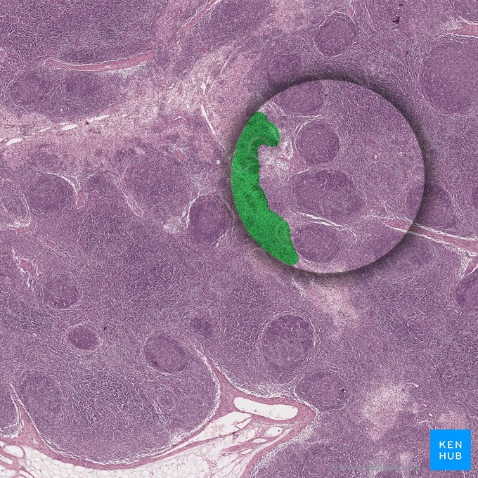 Medulla of lymph node (Medulla nodi lymphoidei); Image: 