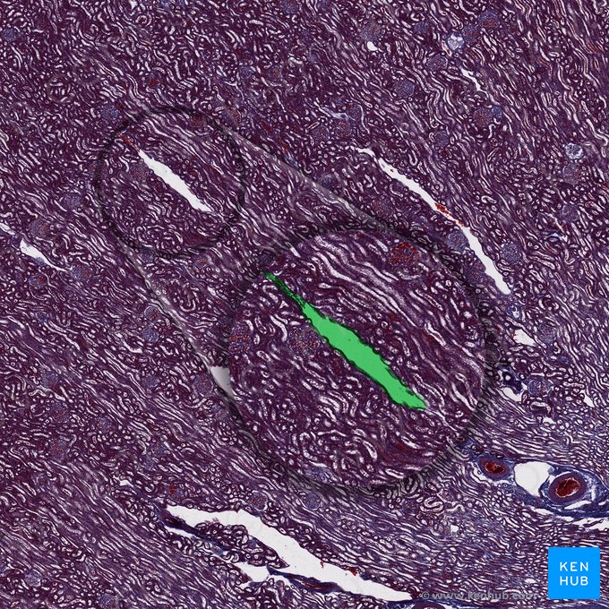 Vena interlobularis (Zwischenläppchenvene); Bild: 