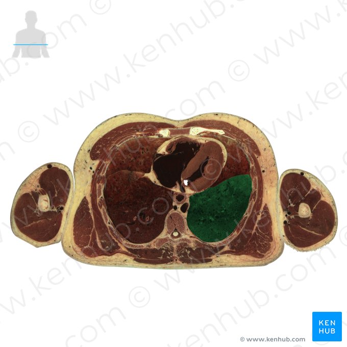 Inferior lobe of left lung (Lobus inferior pulmonis sinistri); Image: National Library of Medicine
