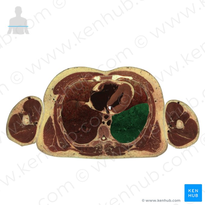 Lobus inferior pulmonis sinistri (Unterlappen der linken Lunge); Bild: National Library of Medicine