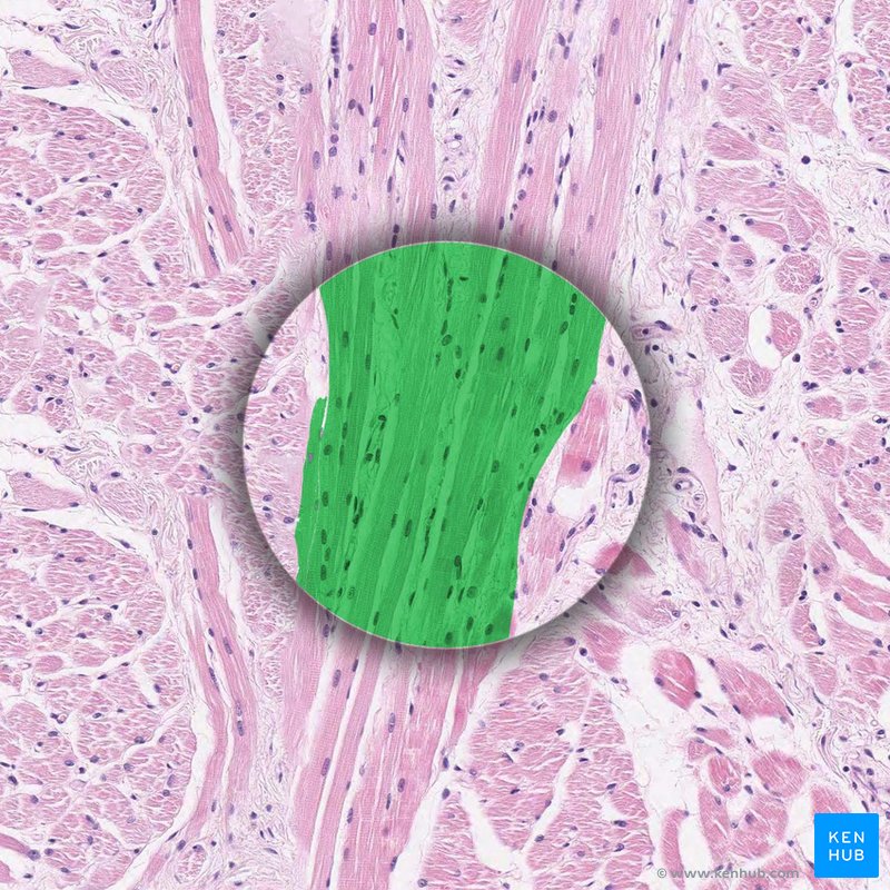 Muscle bundles - histological slide