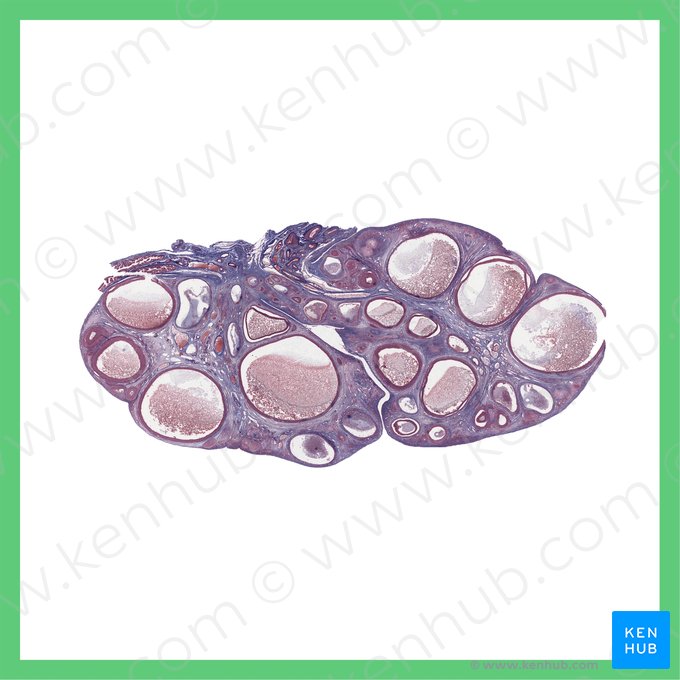 Ovarium (phasis ovulatoria) (Eierstock (Ovulationsphase)); Bild: 