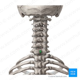 Processus spinosus vertebrae C7 (Dornfortsatz des Wirbels C7); Bild: Yousun Koh
