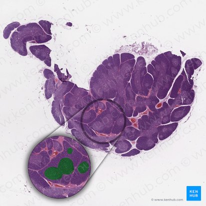 Zone médullaire du ganglion lymphatique (Medulla); Image : 
