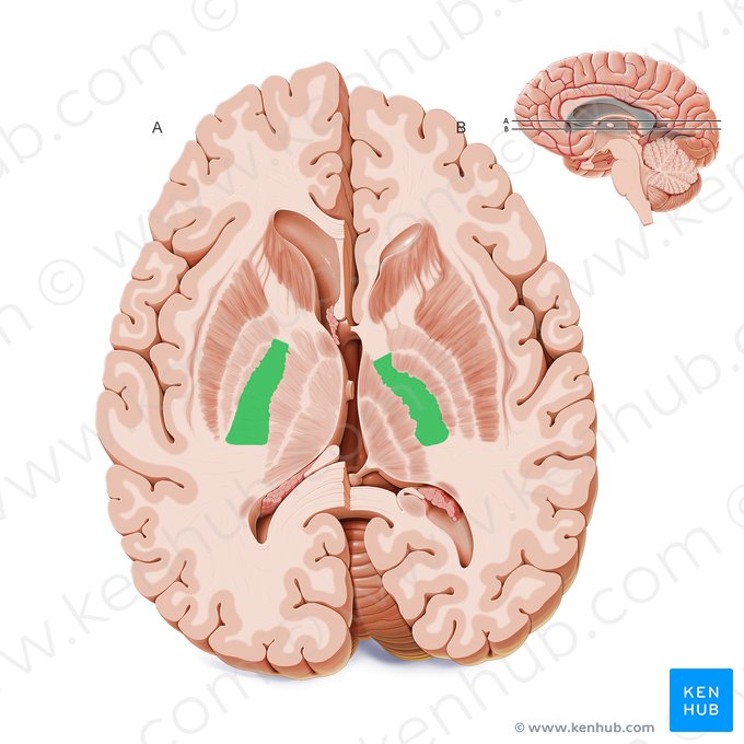 Posterior limb of internal capsule (Crus posterius capsulae internae); Image: Paul Kim