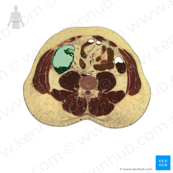 Ascending colon (Colon ascendens); Image: National Library of Medicine