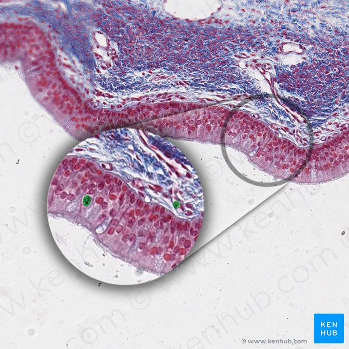 Mastocitos (Mastocytus); Imagen: 