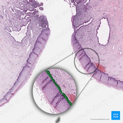 Capa basal del epitelio escamoso; Imagen: 