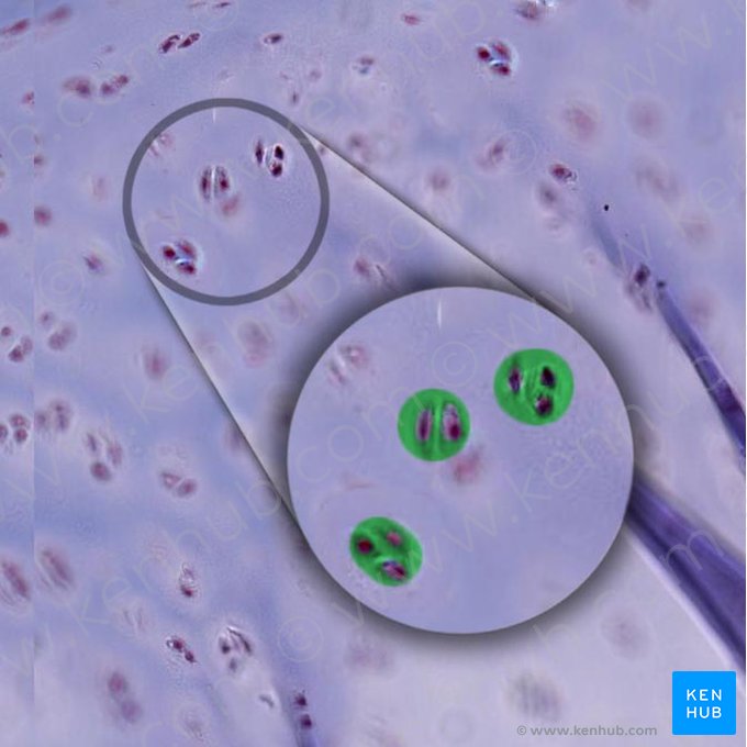 Cartilage lacuna (Lacuna cartilaginea); Image: 