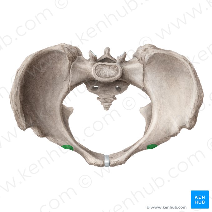 Iliopubic eminence of hip bone (Eminentia iliopubica ossis coxae); Image: Liene Znotina