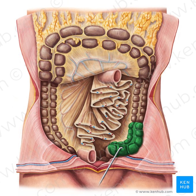 Cólon sigmoide (Colon sigmoideum); Imagem: Irina Münstermann