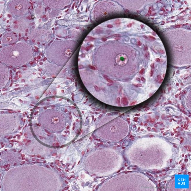Nucléolo das células ganglionares (lâmina histológica)