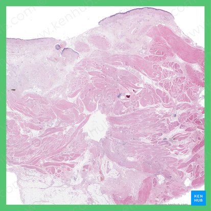 Urinary bladder (Vesica urinaria); Image: 