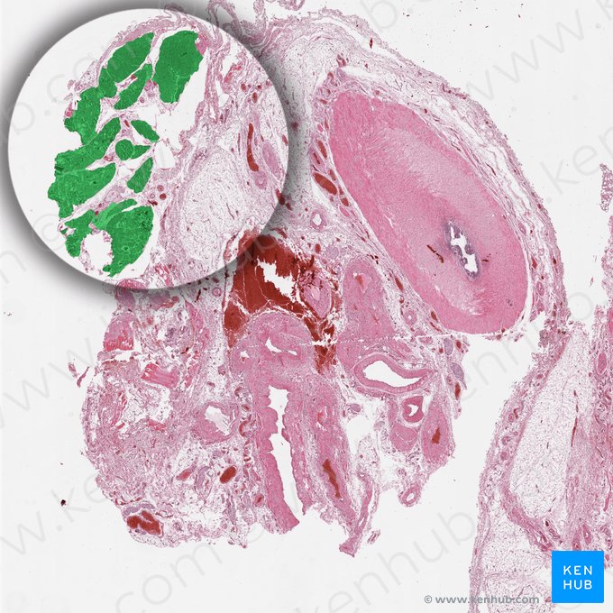 Músculo cremaster (Musculus cremaster); Imagem: 