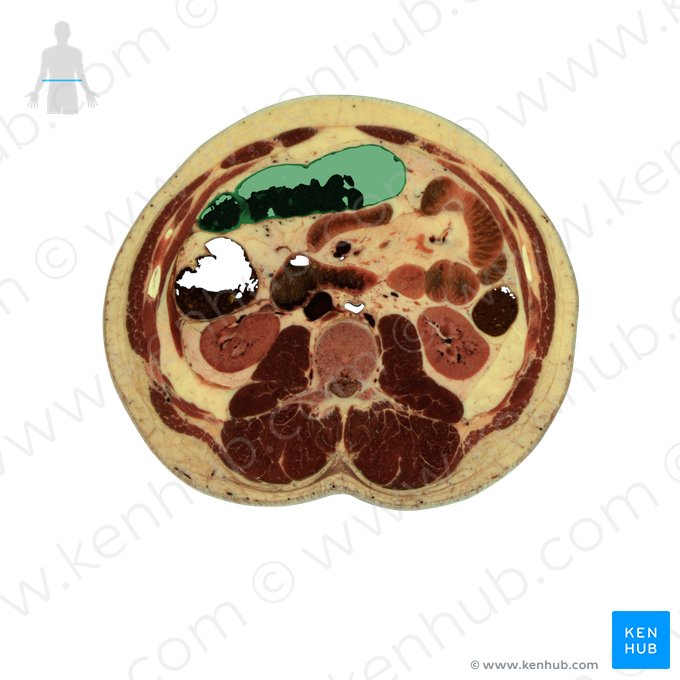 Transverse colon (Colon transversum); Image: National Library of Medicine