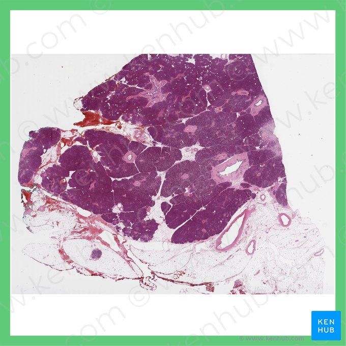 Corpus pancreatis (Bauchspeicheldrüsenkörper); Bild: 