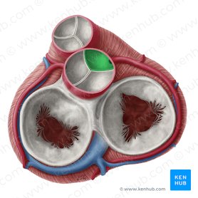 Valvula coronaria dextra valvae aortae (Rechtskoronare Tasche der Aortenklappe); Bild: Yousun Koh
