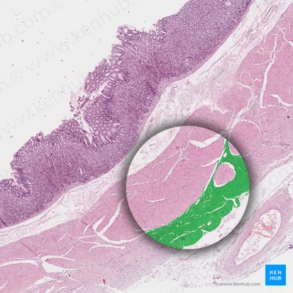 Longitudinal layer of muscular coat of stomach (Stratum longitudinale tunicae muscularis gastris); Image: 