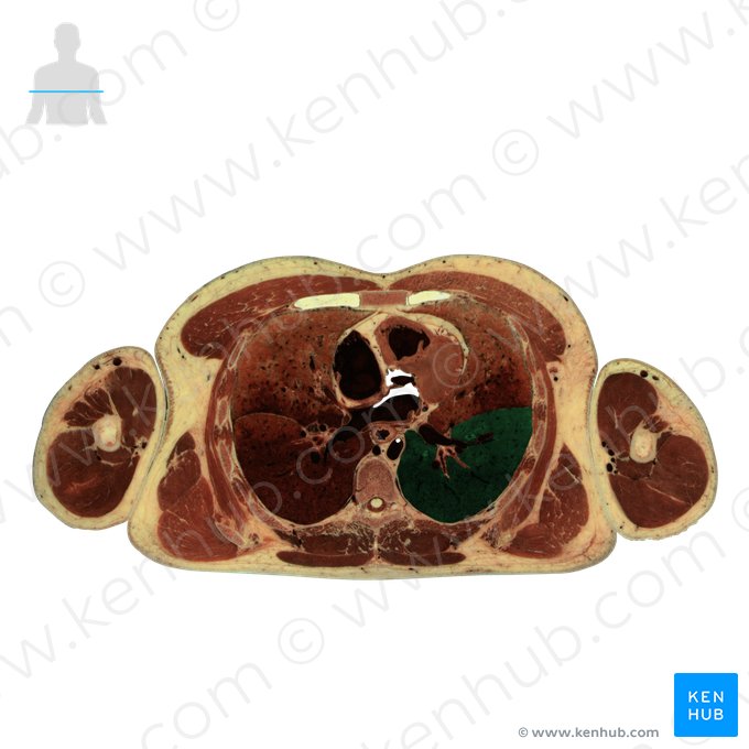 Inferior lobe of left lung (Lobus inferior pulmonis sinistri); Image: National Library of Medicine