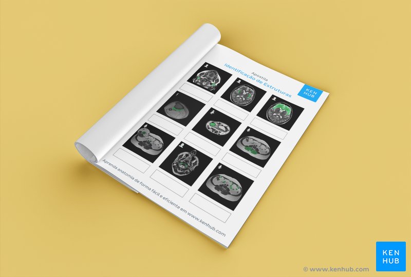 Teste suas habilidades de identificar estruturas anatômicas com os nossos exercícios sobre ressonância magnética em PDF (download abaixo!)