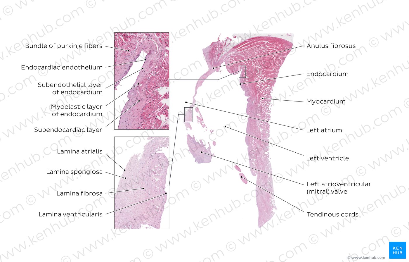 Left ventricle wall and left atrioventricular (mitral valve). Stain: H&E. Low magnification.