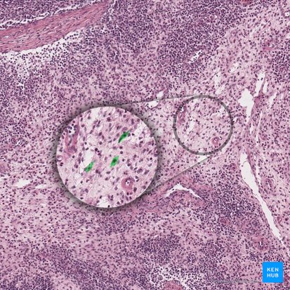 Fibroblast (Fibroblastus); Image: 