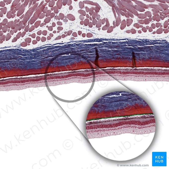 Capa coriocapilar (Lamina choroidocapillaris); Imagen: 