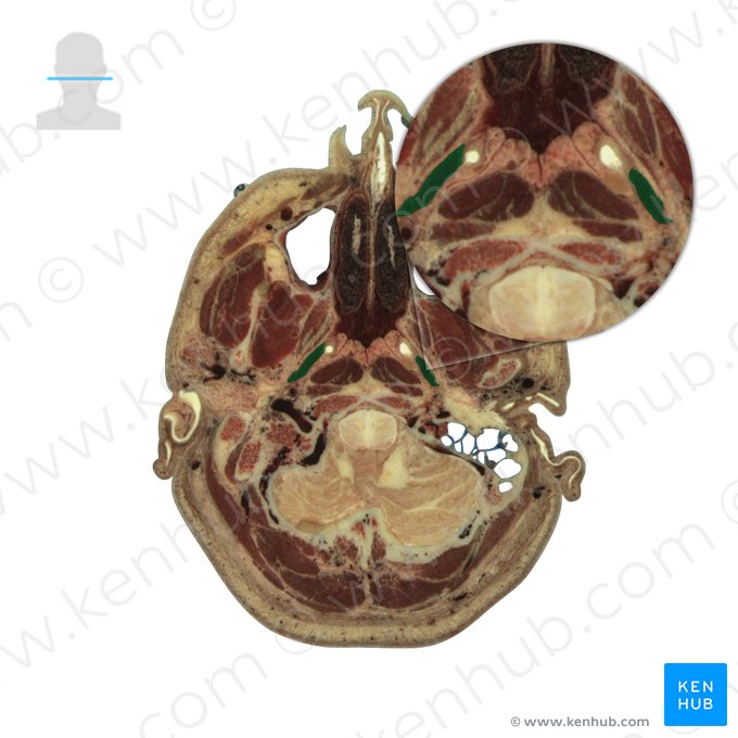 Levator veli palatini (Musculus levator veli palatini); Image: National Library of Medicine