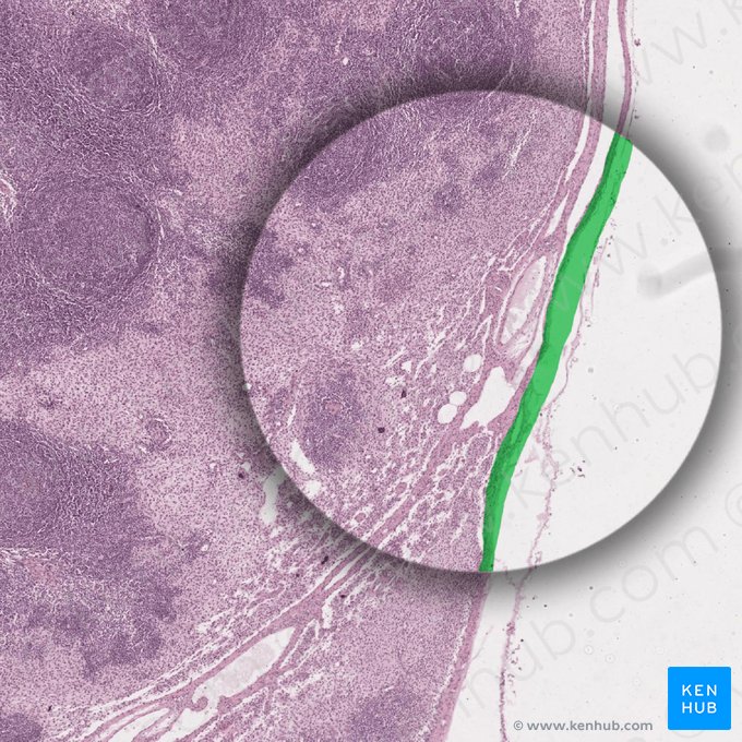 Capsula nodi lymphoidei (Kapsel des Lymphknotens); Bild: 