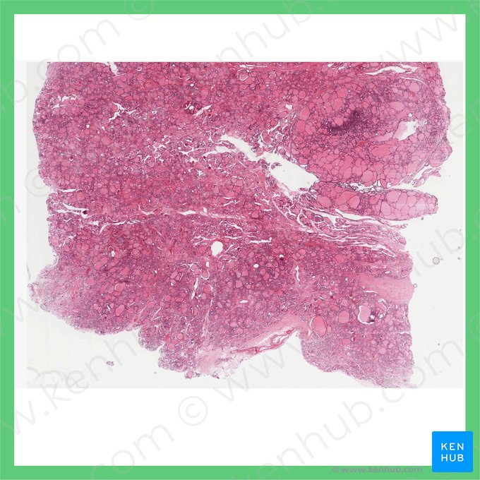 Glande thyroïde (Glandula thyroidea); Image : 