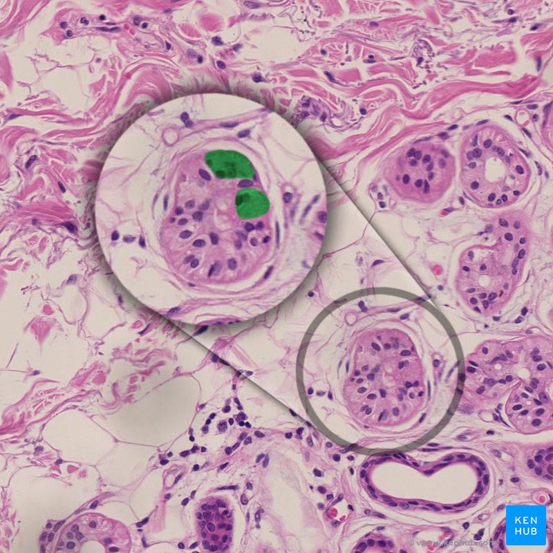 Dark cells - histological slide