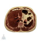 Eleventh thoracic vertebra level