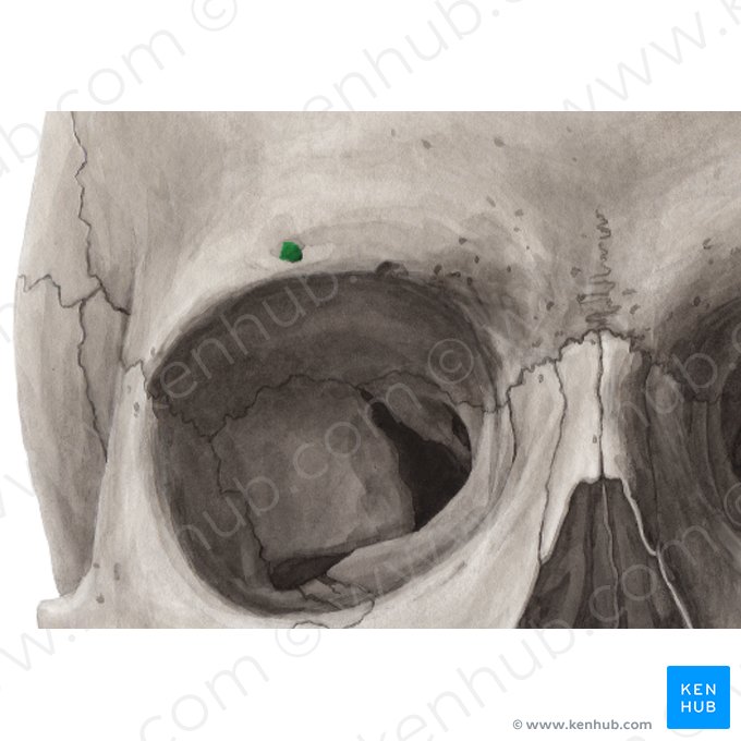 Foramen supraorbitale ossis frontalis (Oberaugenhöhlenloch); Bild: Yousun Koh