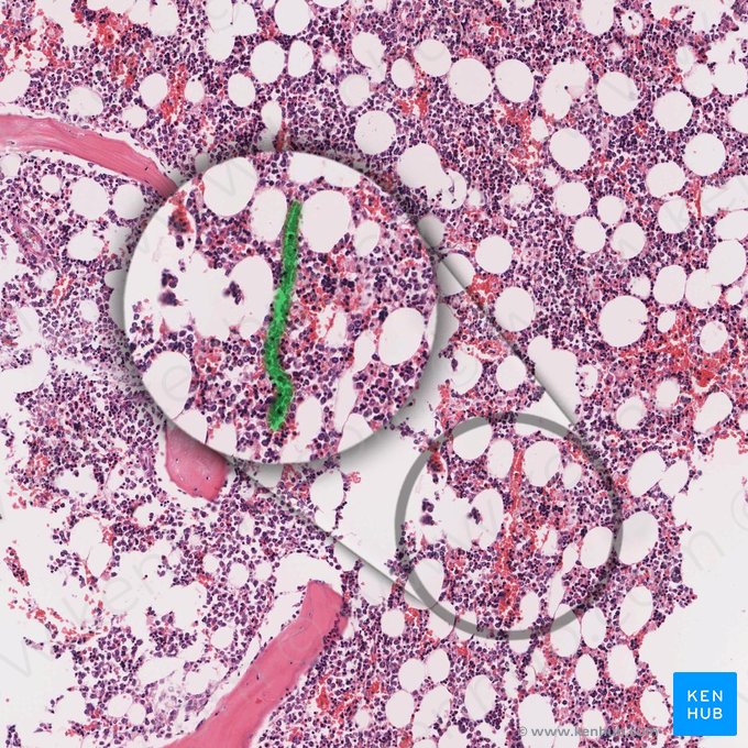 Sinusoidal capillary (Vas sinusoideum); Image: 