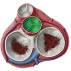 Aortic valve