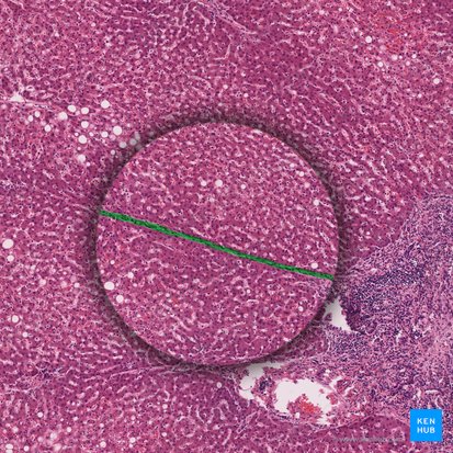 Interlobular septum (Septum interlobularis); Image: 