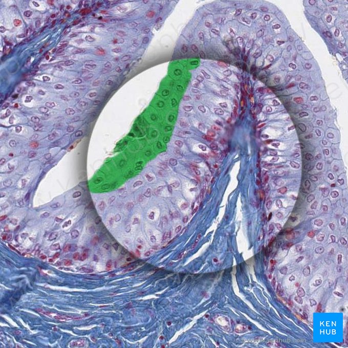 Superficial layer of transitional epithelium; Image: 