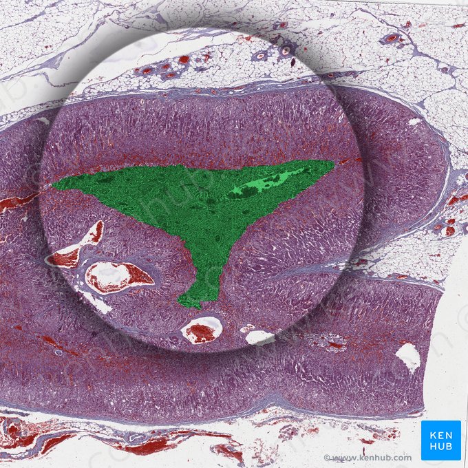 Medula adrenal; Imagem: 